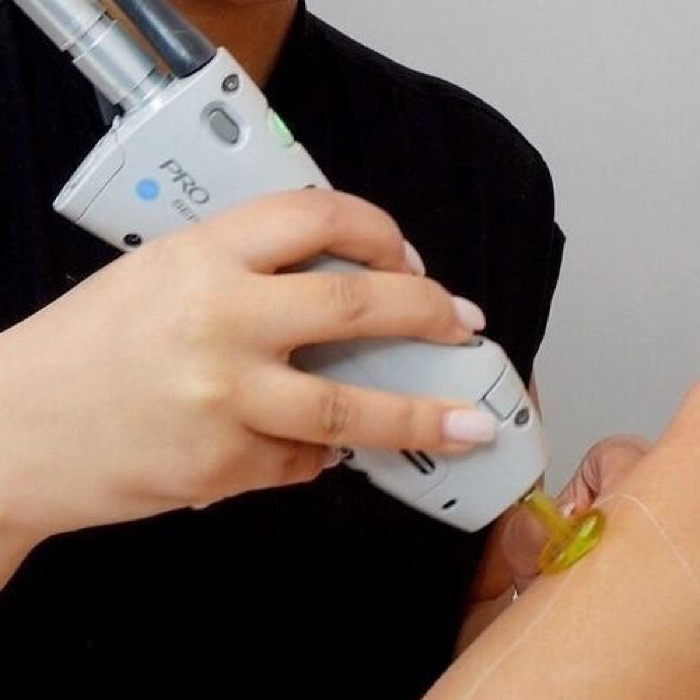 Embout du laser GentleMax Pro pendant une séance